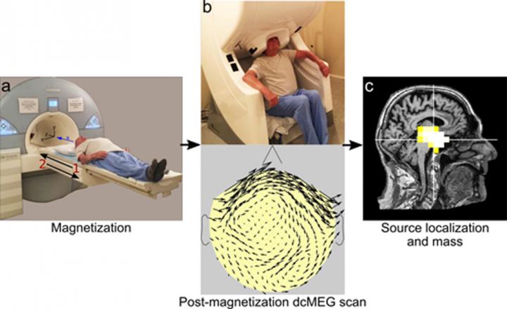 dcMEG to Measure Magnetite Levels in the Brain