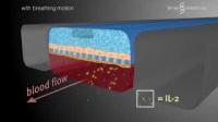 Researchers Mimic Pulmonary Edema in Lung-on-a-Chip