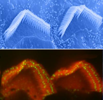 Stereocilia On Top of Auditory Hair Cells