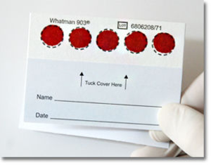 Dry Blood Spot card