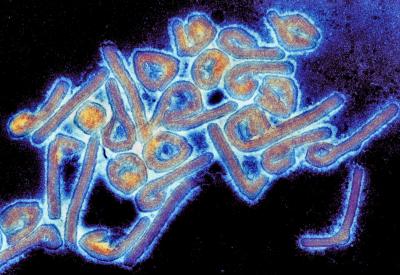 Electron Microscope Photo of the Marburg Virus