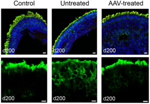 NPHP5-deficient retinal organoids