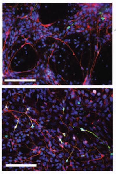 Catecholamine-producing Neurons