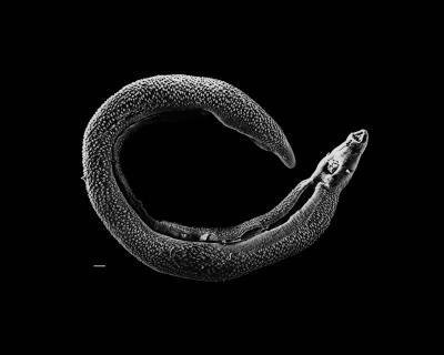 Schistosome Parasites