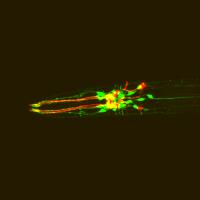 Fluorescence Micrograph of C. elegans