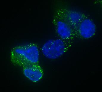 Brain Tumor Stem Cell
