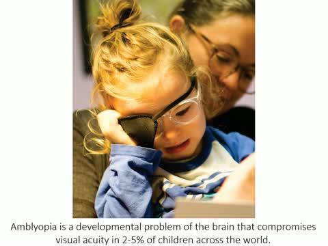 SUNY Optometry Researchers: Bright Lights Outdoors May Help Treat 'Lazy Eye' in Children