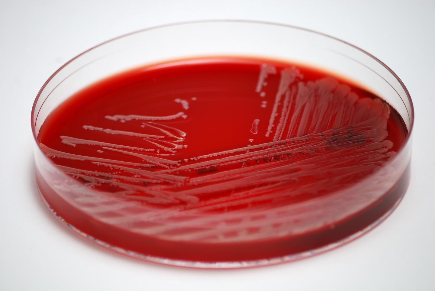 Statin Use Appears to Reduce Risk of Serious Bacterial Bloodstream Infection