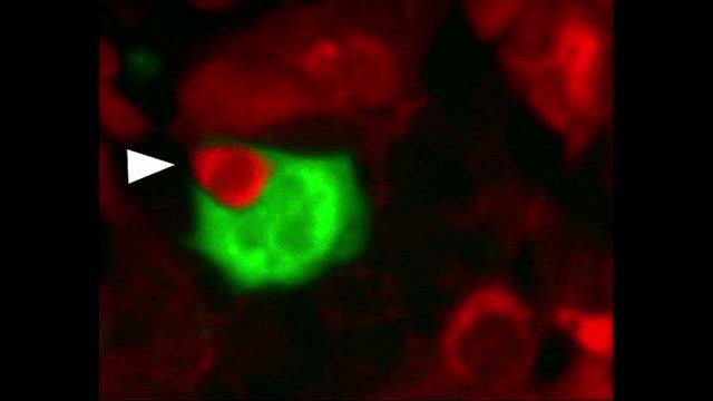 A Senescent Cancer Cell Engulfs a Neighboring Cell