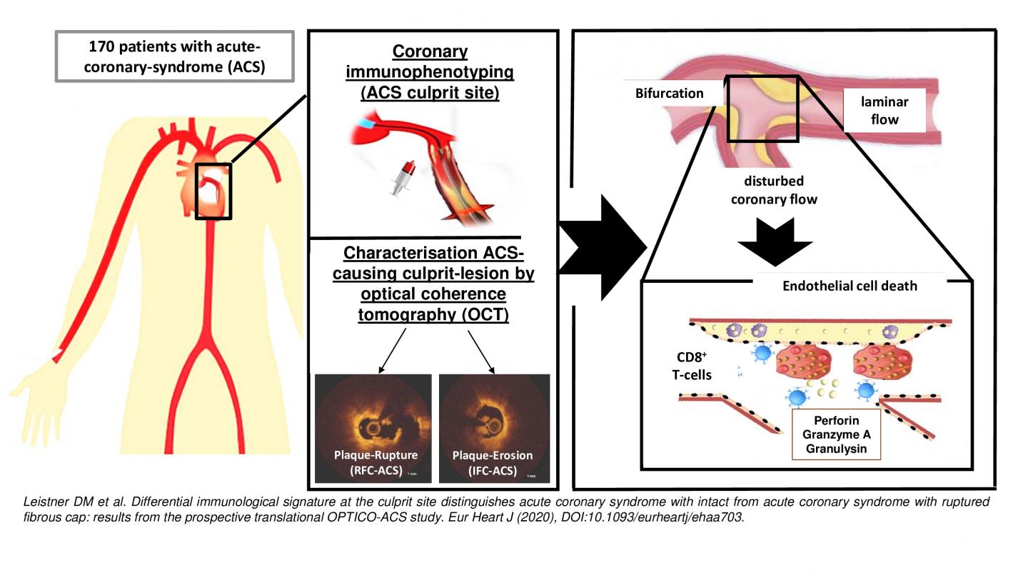 The OPTICO-ASC study