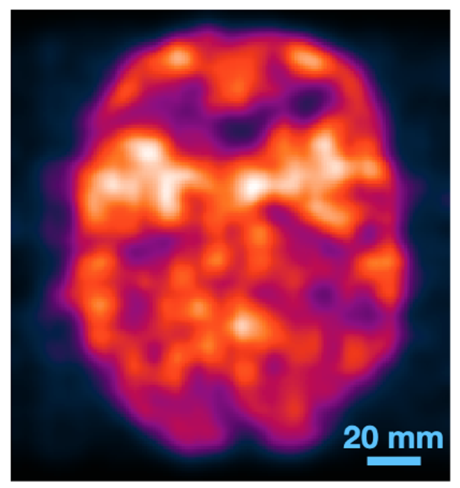 Medical Imaging Without Tomography: Detector Advance Could Lead to Cheaper, Easier Medical Scans