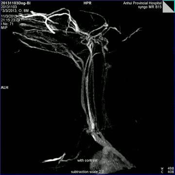 Magnetic Resonance Angiography
