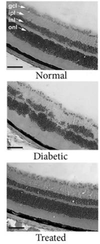 Receptor Activation Protects Retina from Diabetes Destruction (2 of 2)
